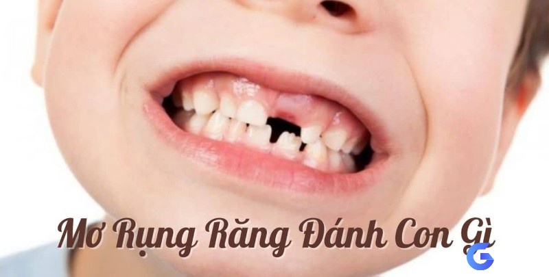 Giải mã nằm mơ thấy rụng răng đánh số gì cùng Gi8 nhé!